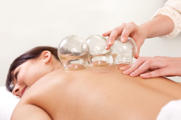 Cupping Therapy - Dr Maegan Knutson Specialty Natural Medicine Mukilteo Everett Seattle Cupping Therapy - Dr Maegan Knutson Specialty Natural Medicine Mukilteo Everett Seattle