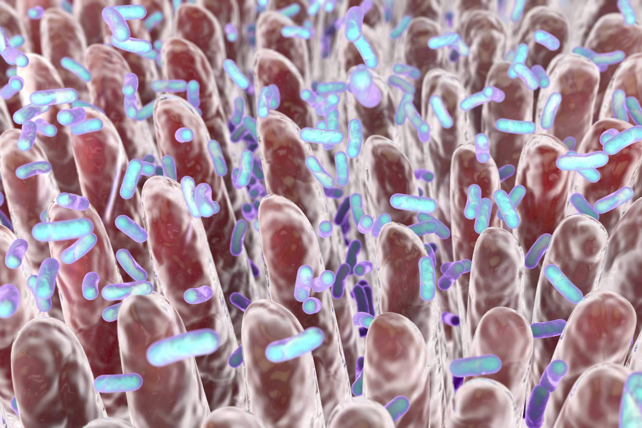 Irritable Bowel Syndrome (IBS) – SIBO
