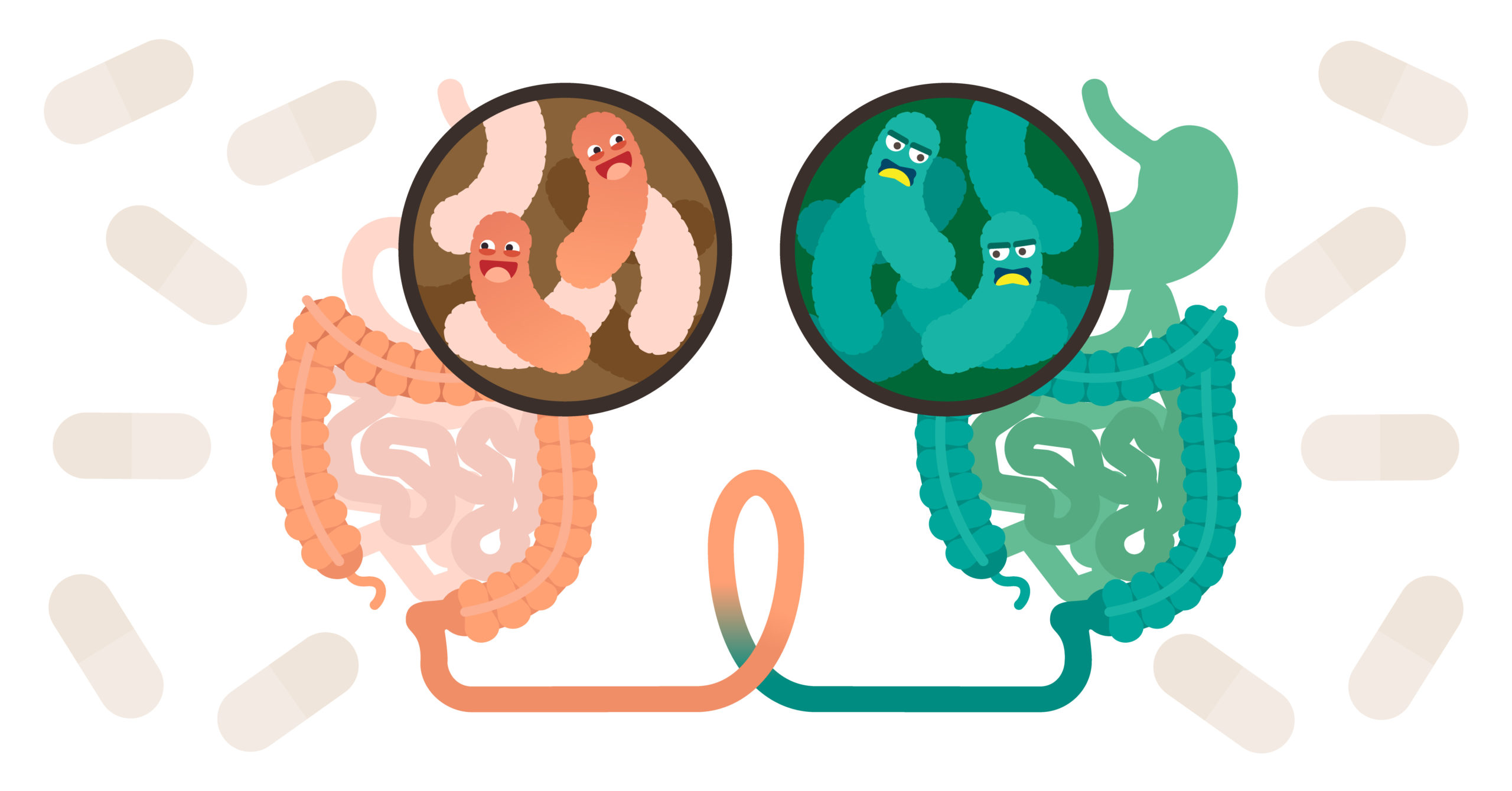 Sterile - Fecal microbiota transplant